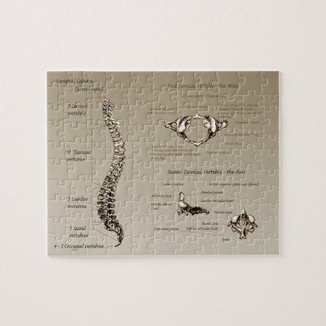 Quebra-cabeça Espinha (Horizontal)