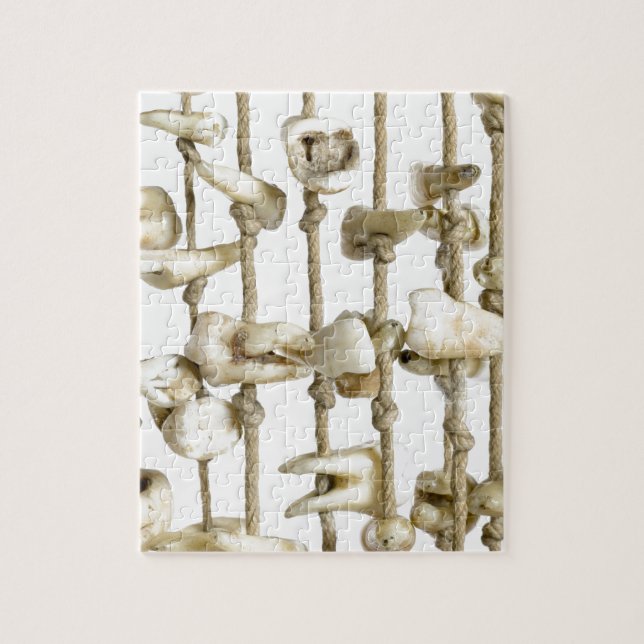 Quebra-cabeça Fotografia dental engraçada dentista extraído dos (Vertical)