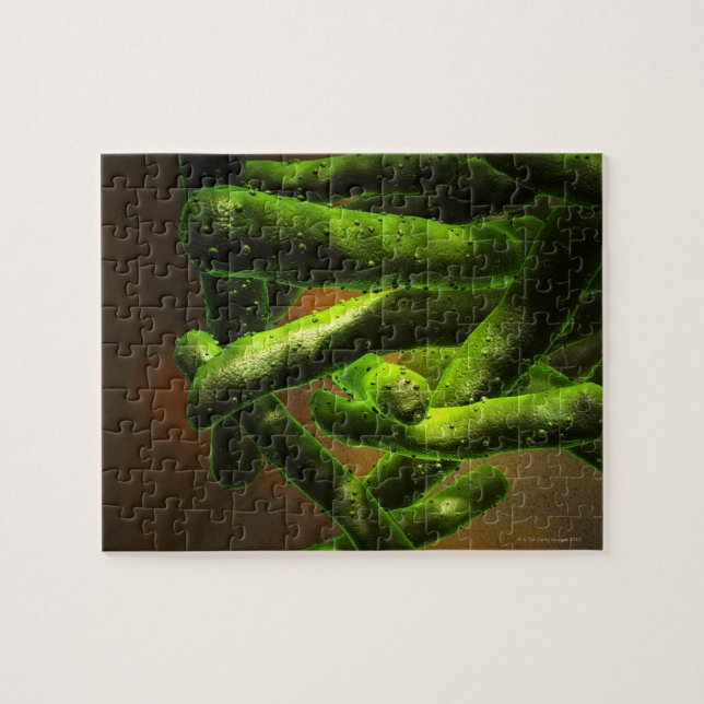 Quebra-cabeça Micobacteria Tuberculose (Horizontal)