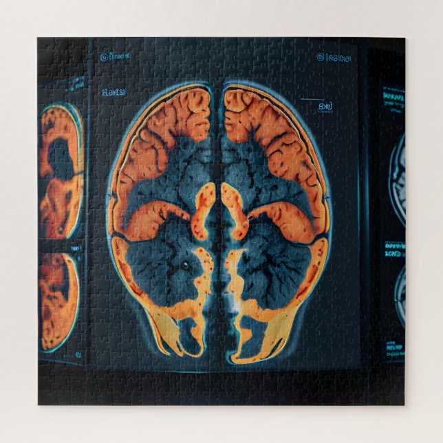 Quebra-cabeça ressonância magnética cerebral (Vertical)