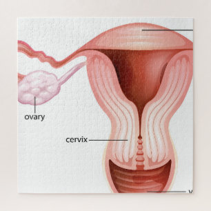 Quebra-cabeça Sistema redutor feminino