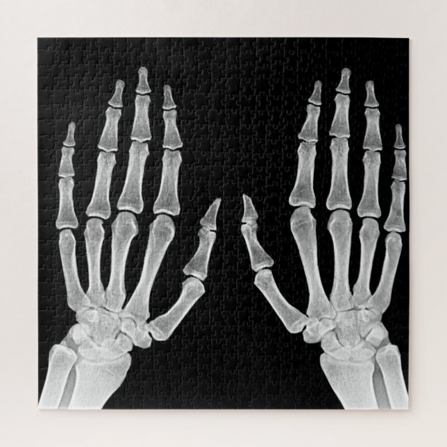 Quebra-cabeça Skeleton Hands Xray Imagem da Anatomia Humana (Vertical)