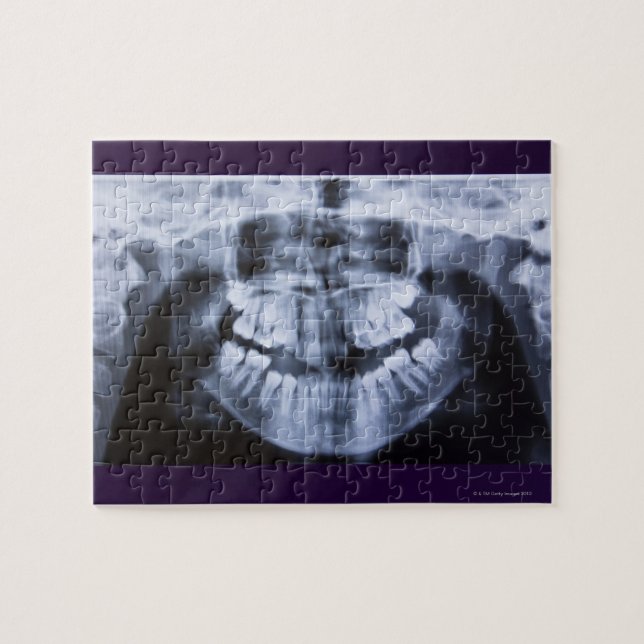 Quebra-cabeça Xray de um jawline feminino levado com panorâmica (Horizontal)