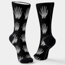 Radiografia da Mão Polidáctil Divertida