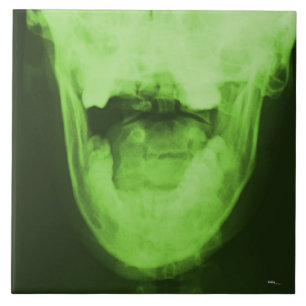 Raios X 3 - Verde radioativo