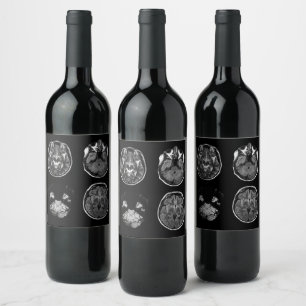 Rótulo De Garrafa De Cerveja Varredura por ressonância magnética do cérebro