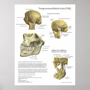 Síndrome Conjunta TMJ Anatomia Poster
