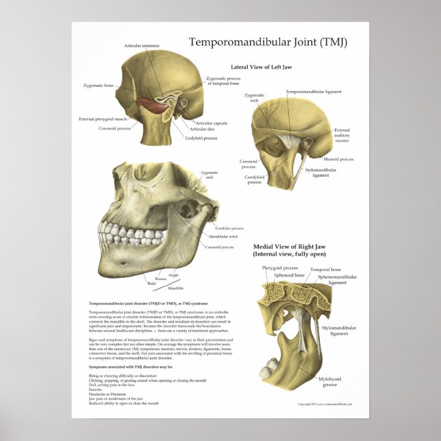 Síndrome Conjunta TMJ Anatomia Poster (Frente)