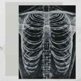 Skeleton Xray Rib Cage Vintage Black White
