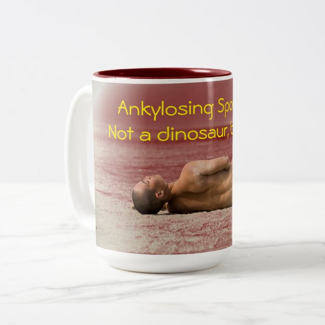 Spondylitis Ankylosing, não uma caneca do (Frente Esquerda)