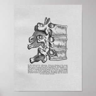 Subluxação Vertebral Quiroprática Impressão