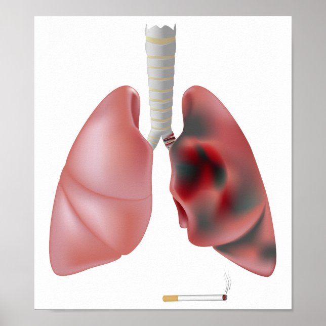 Tabagismo e Poster de cancer pulmonar (Frente)