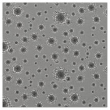 Coronavírus - Cinzas