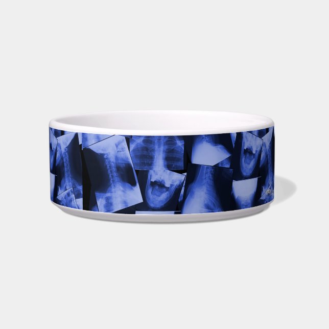 Tigela Raios X - Azul eletromagnético (Direita)