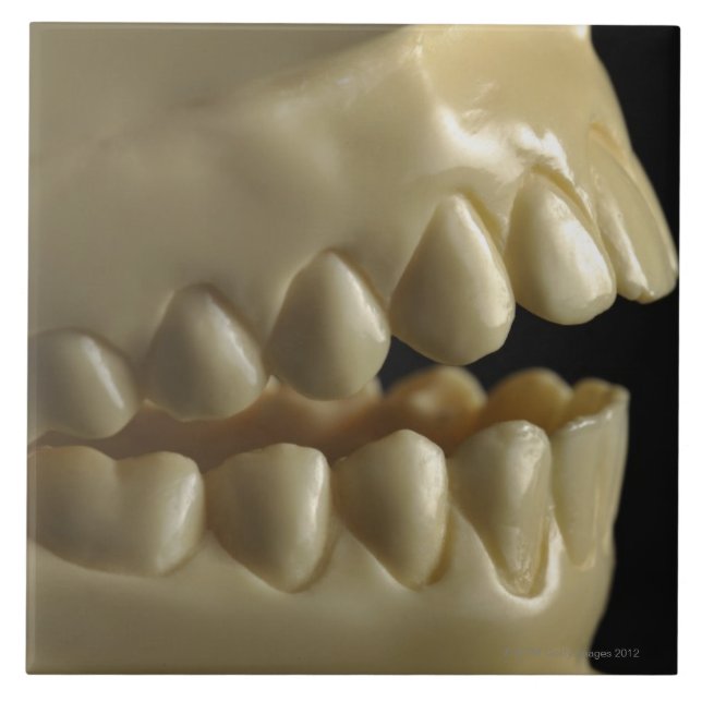 Um modelo dental (Frente)