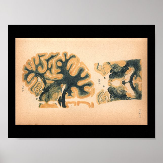 Vintage 1901 Impressão de Anatomia cerebral (Frente)