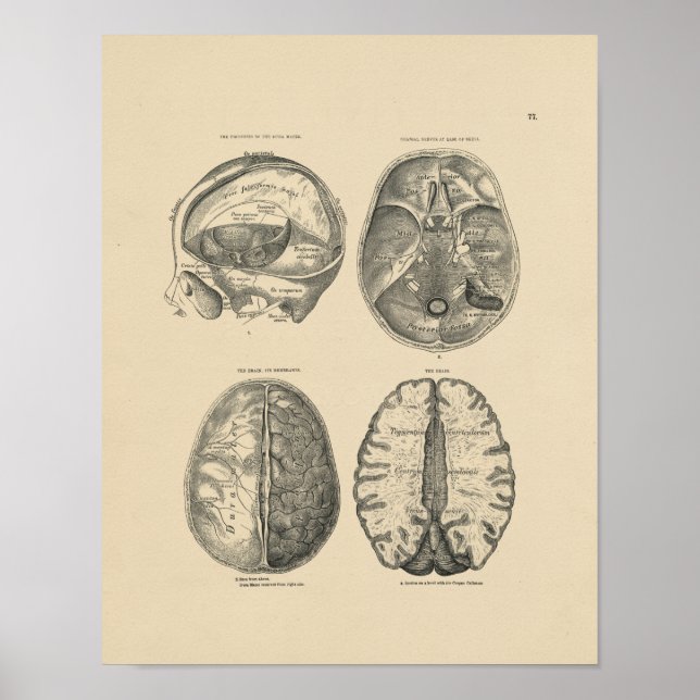 Vintage Brain Skull Anatomy 1880 Impressão (Frente)