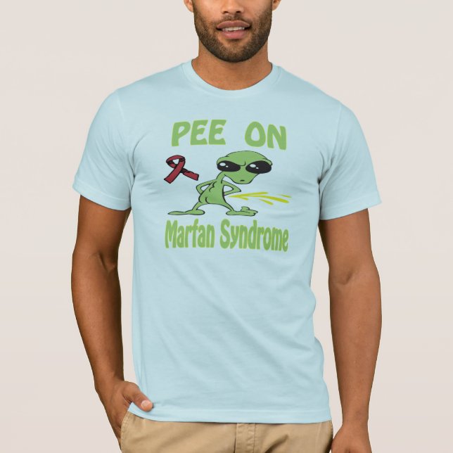 Xixi na camisa da síndrome de Marfan (Frente)